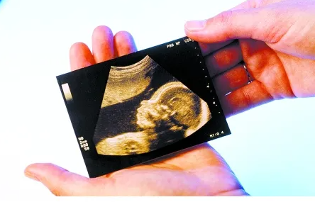 最好的超声数据，看你是否有了宝宝! 最准确的超声数据预测生男生女（快速收集）。
